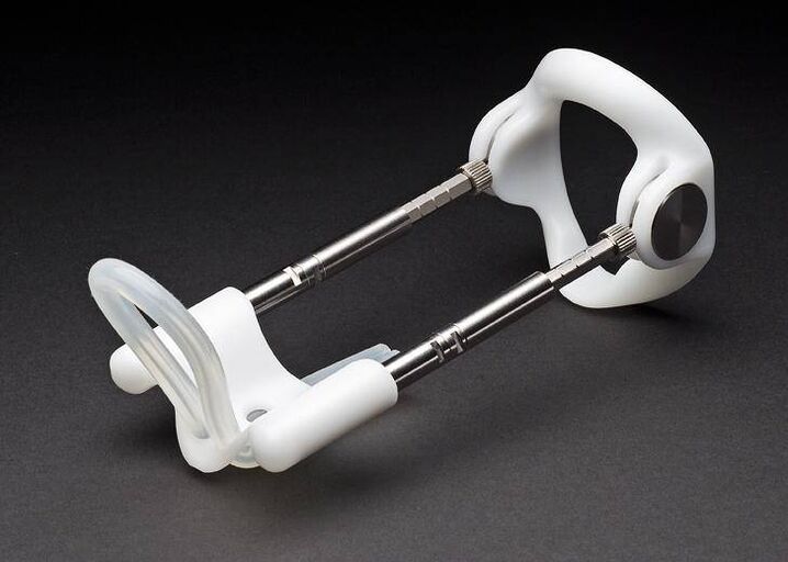 extensor after penis enlargement surgery